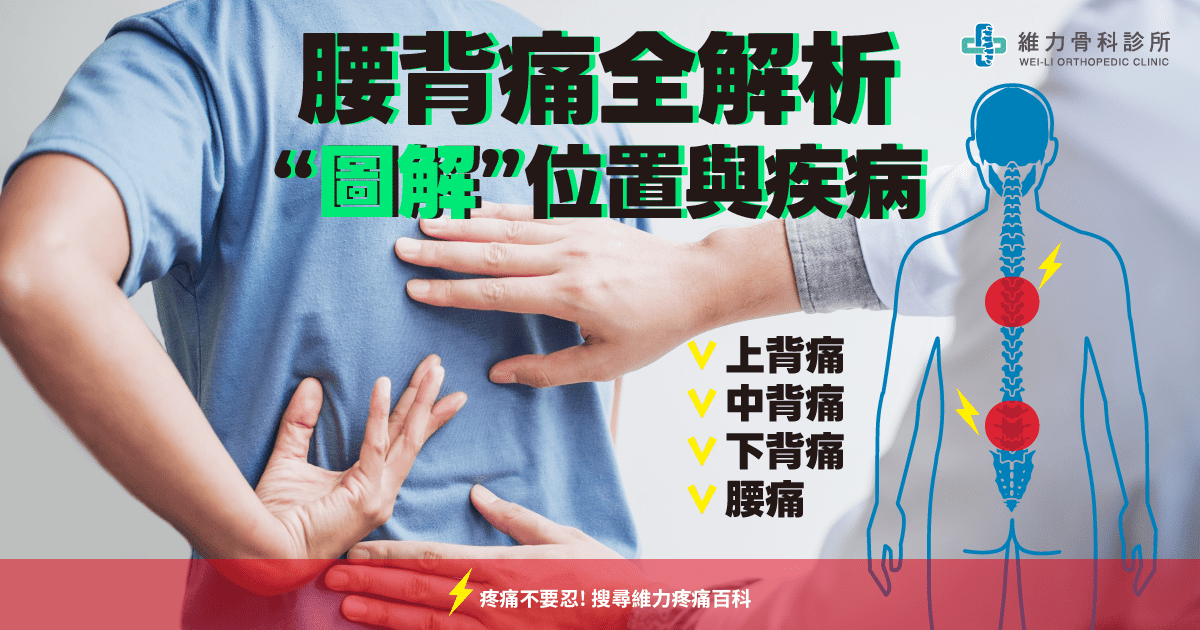 腰背痛全解析；上背痛、中背痛、下背痛、腰痛，圖解位置與疾病 | 維力骨科診所