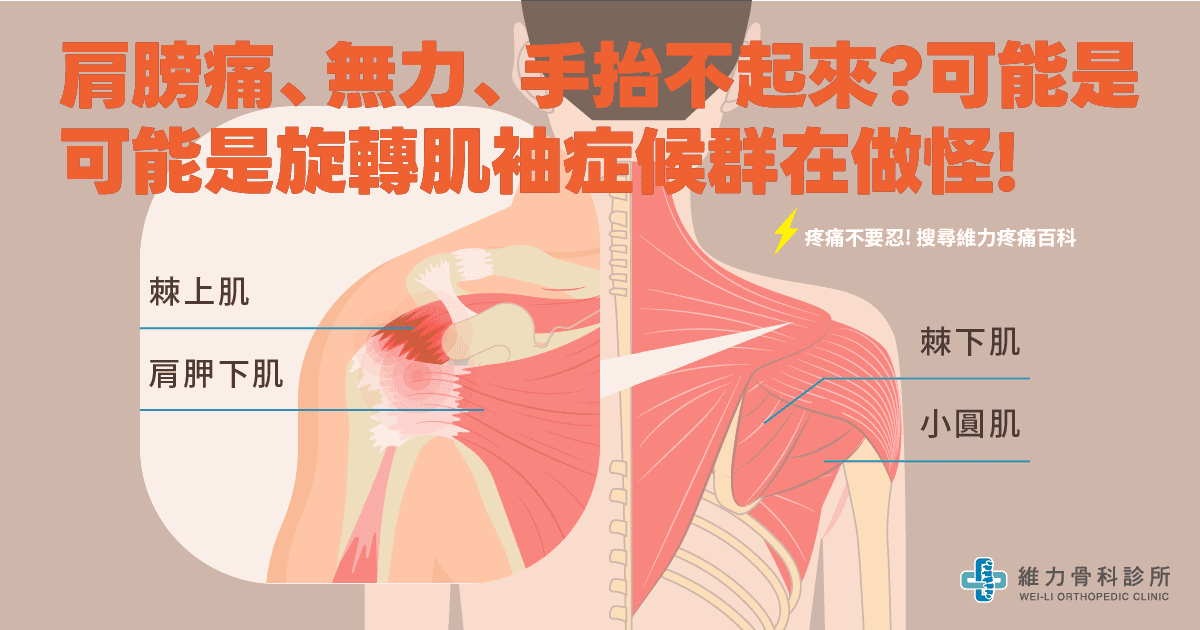 肩膀痛、無力、手抬不起來?可能是複雜的旋轉肌袖症候群在做怪! | 維力骨科診所