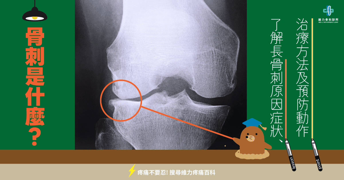 绚丽的什么是骨刺有什么症状的图像