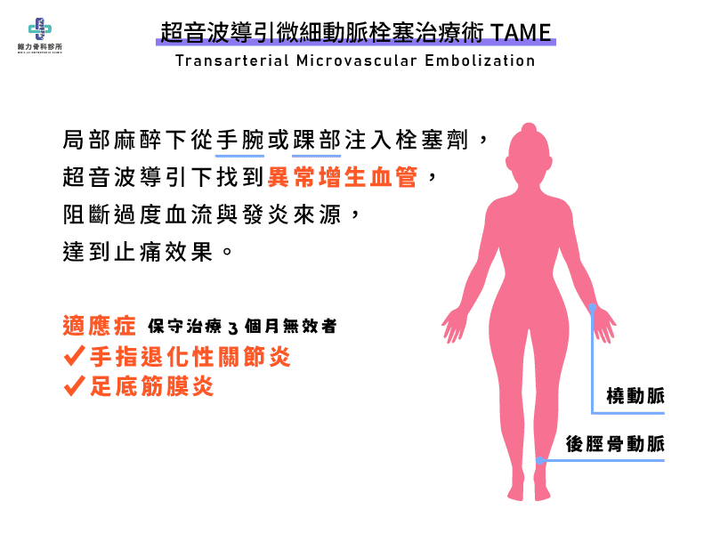 什麼是超音波導引微細動脈栓塞治療術