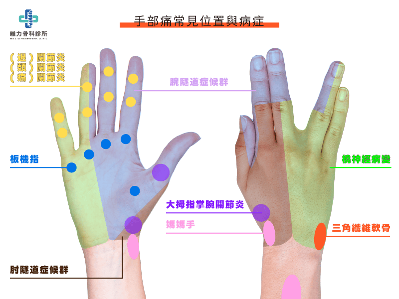 手痛位置與可能病症