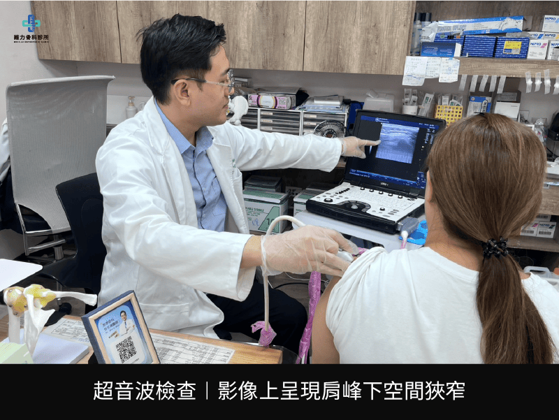 肩膀超音波檢查