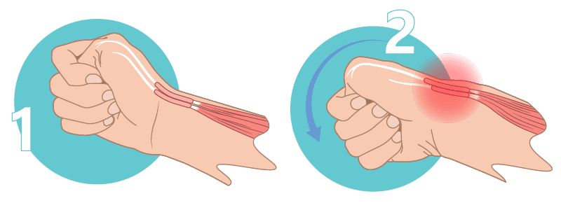 媽媽手痛點位置