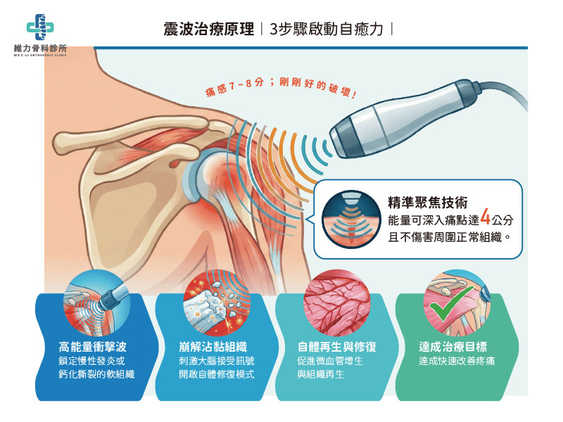 體外震波的治療原理