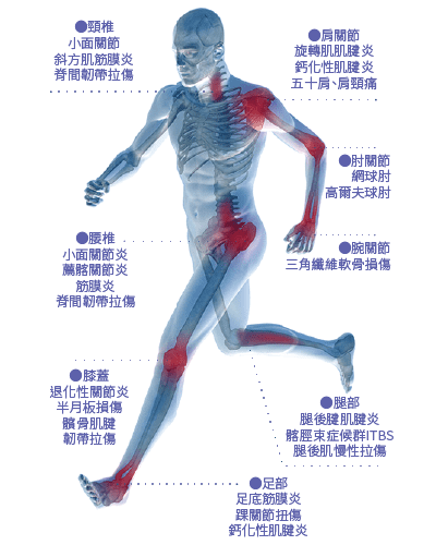 震波適應症