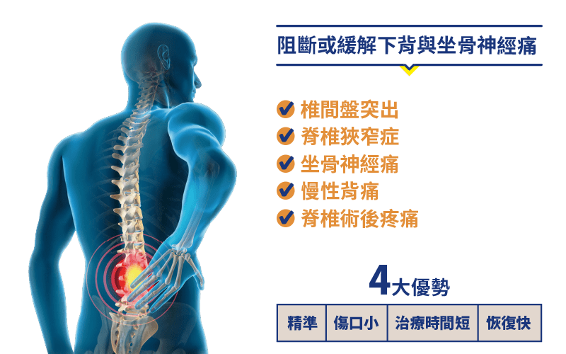 脊椎介入疼痛治療