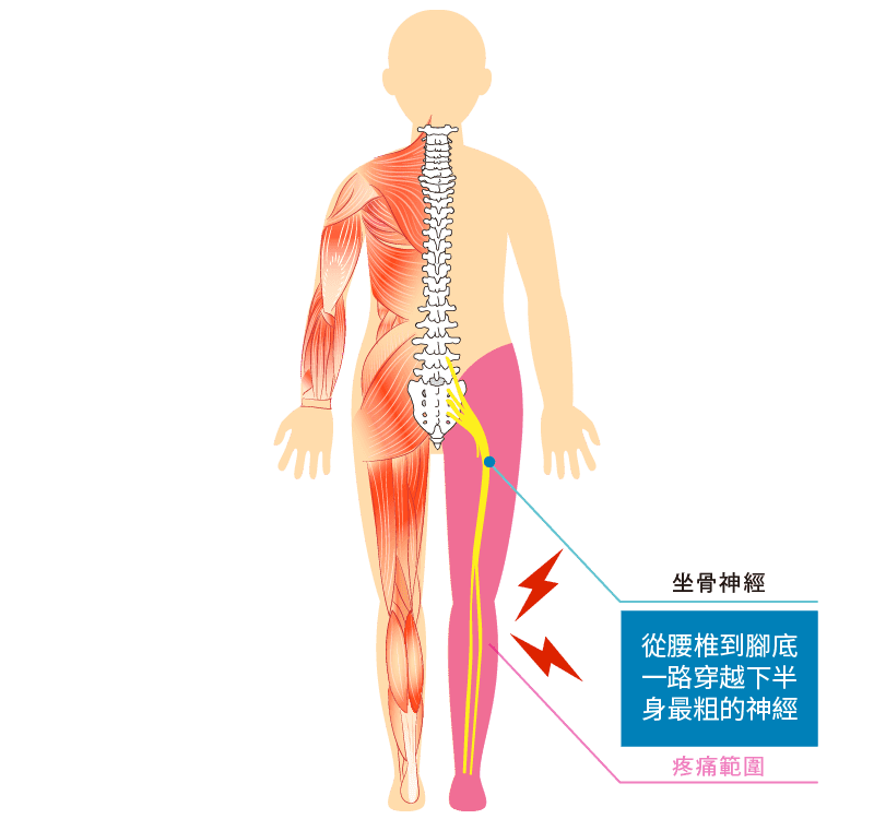 01坐骨神經_1.png 坐骨神經