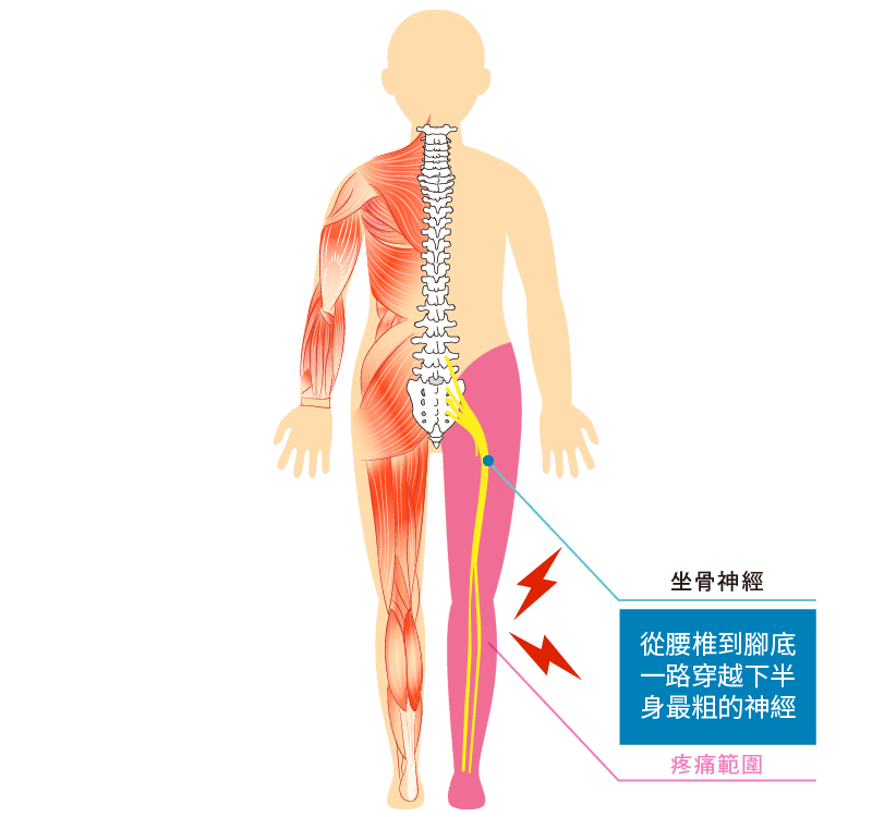 坐骨神經