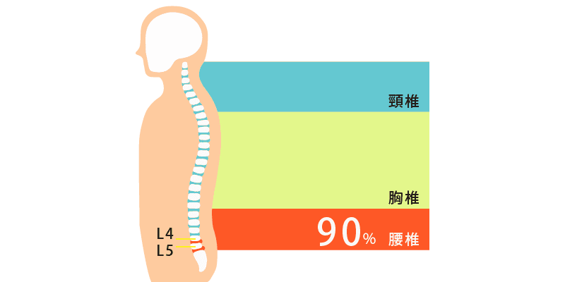 常見的椎間盤突出位置