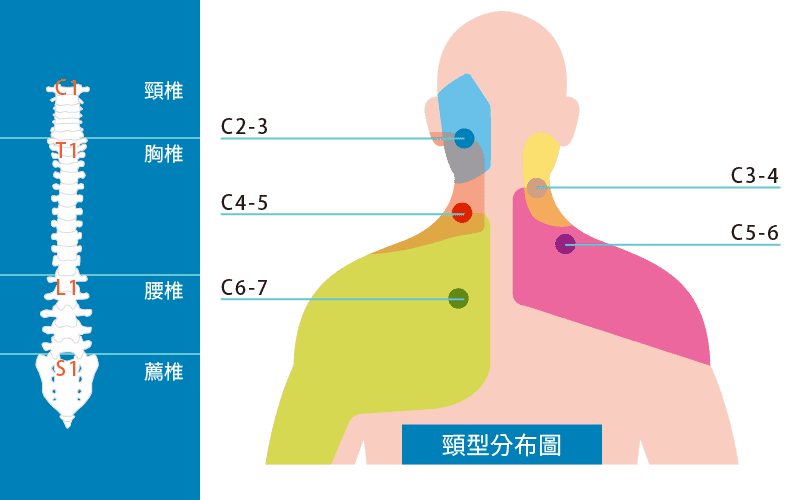 頸型