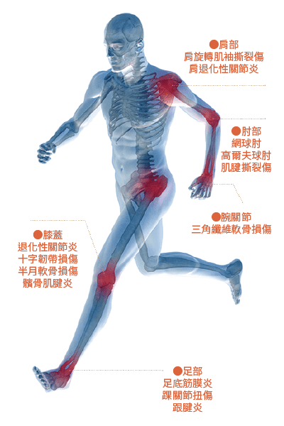 06增生治療_4.png PRP適應症