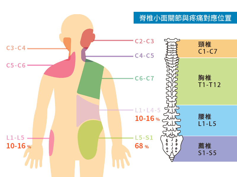 小面關節炎疼痛位置