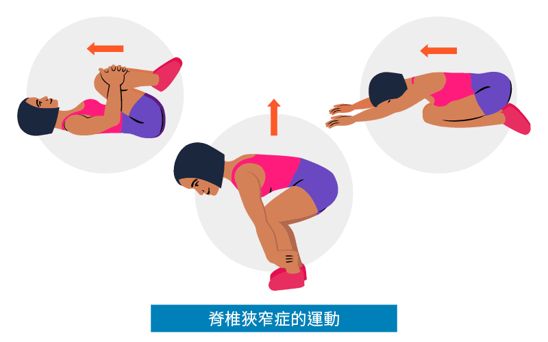 脊椎狹窄症的運動