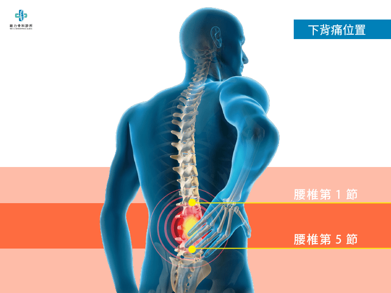 下背痛位置