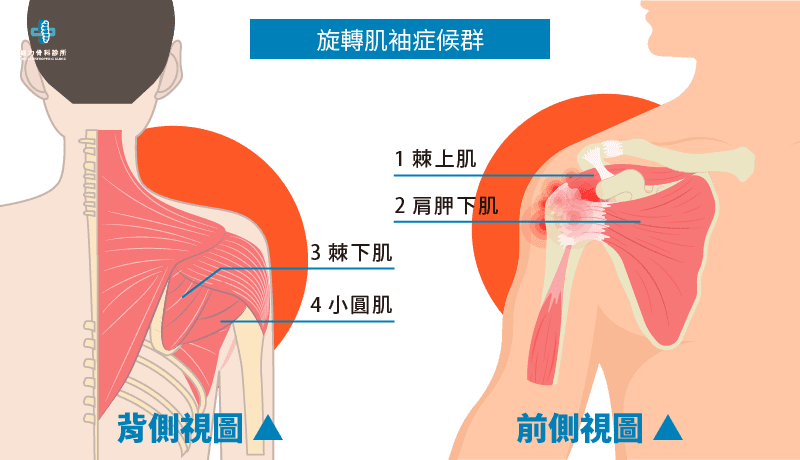 什麼是旋轉肌袖