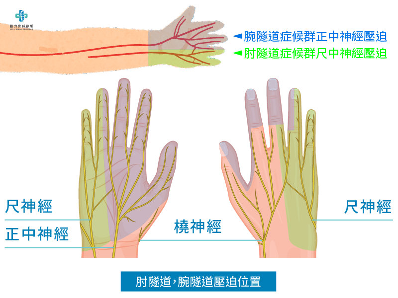 肘隧道與腕隧道手麻位置