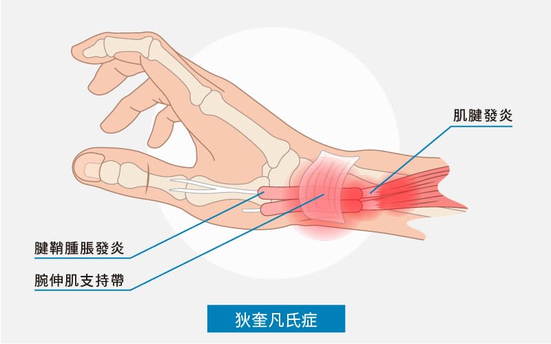 媽媽手