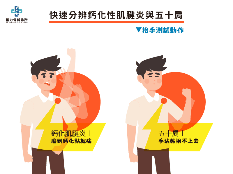 可透過抬手測試分辨鈣化性肌腱炎或五十肩