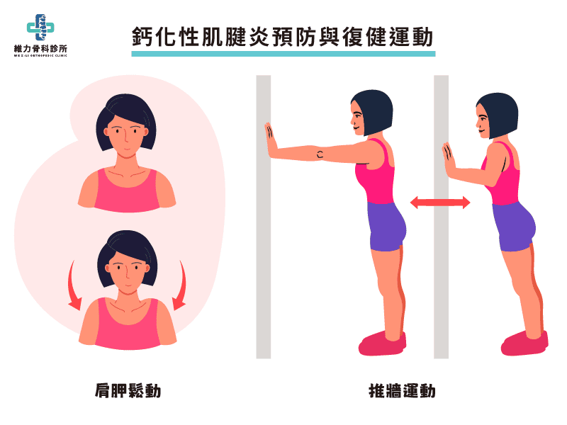 預防鈣化性肌腱炎復健運動