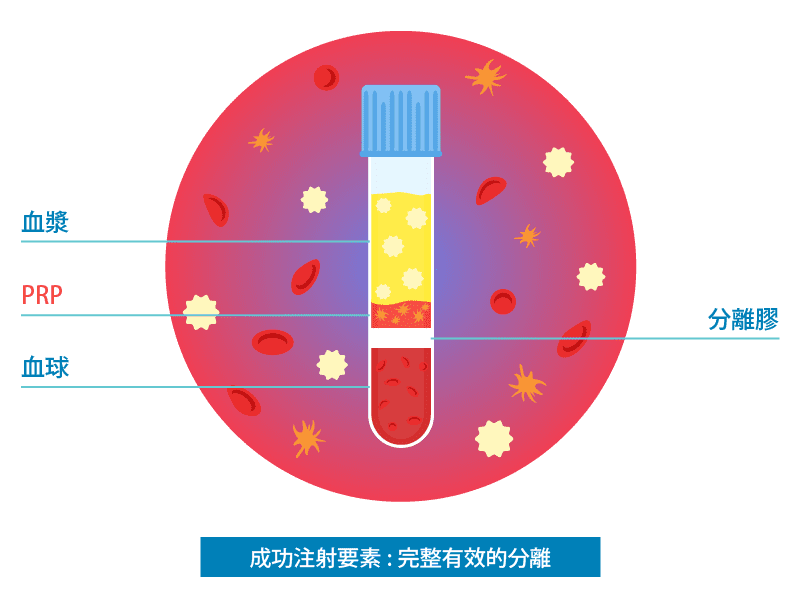 15prp_2.png prp有效的關鍵