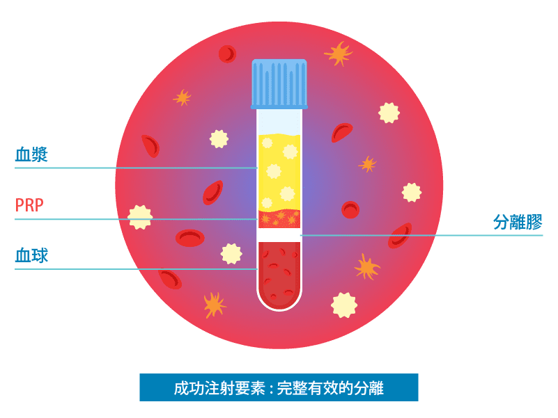 prp有效的關鍵