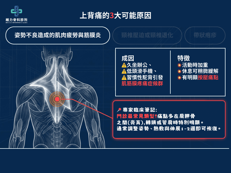 上背痛的可能原因姿勢不良造成的肌肉疲勞與筋膜炎