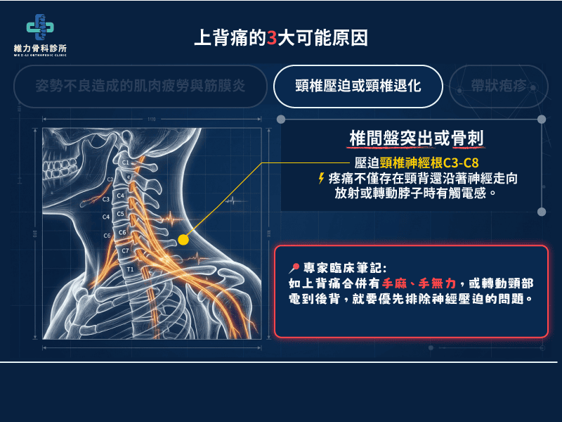 上背痛可能原因頸椎壓迫或頸椎退化