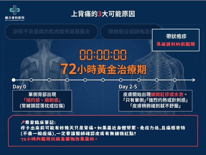 上背痛的可能原因帶狀疱疹初期症狀