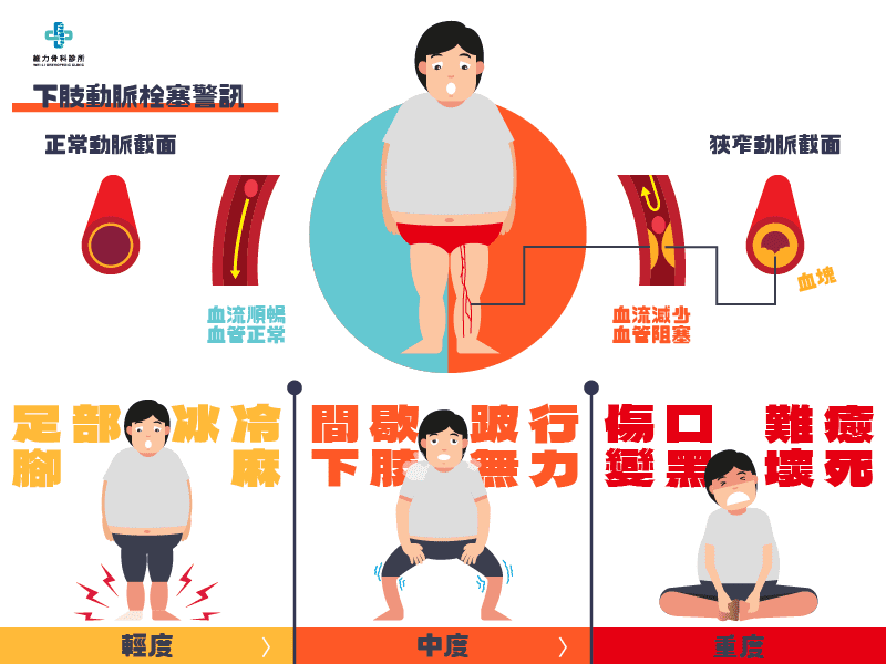 腳底痛腳中風症狀