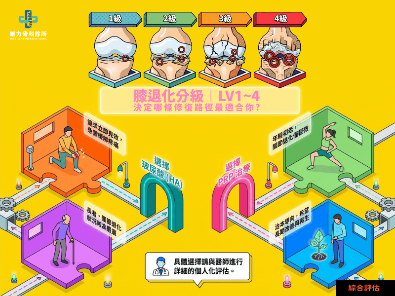 按膝蓋退化分級選擇治療