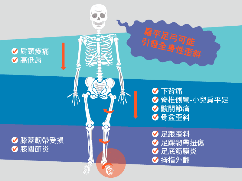 扁平足合併出現症狀