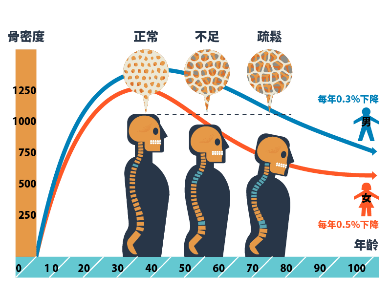 骨質密度與年紀