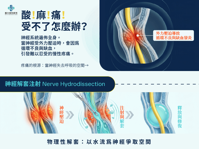 為什麼神經壓迫會引起痠麻痛及神經解套注射原理