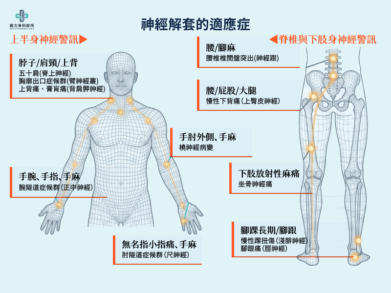 神經解套的適應症
