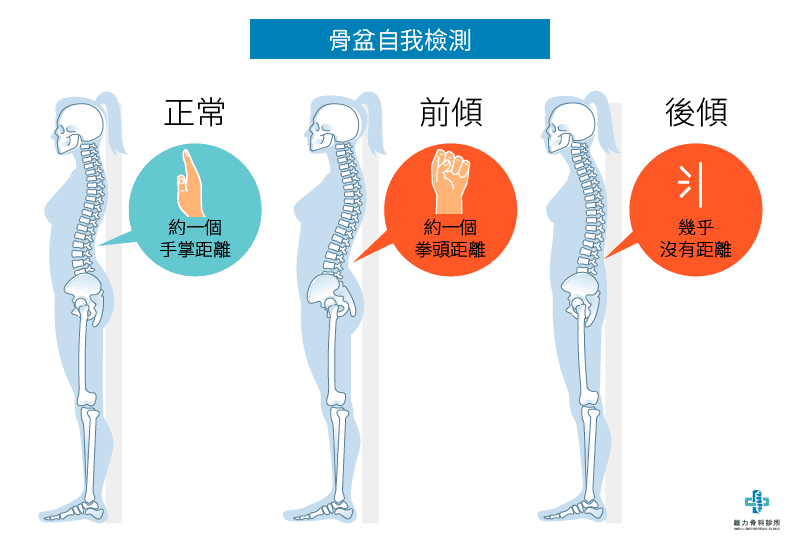 骨盆自我檢測