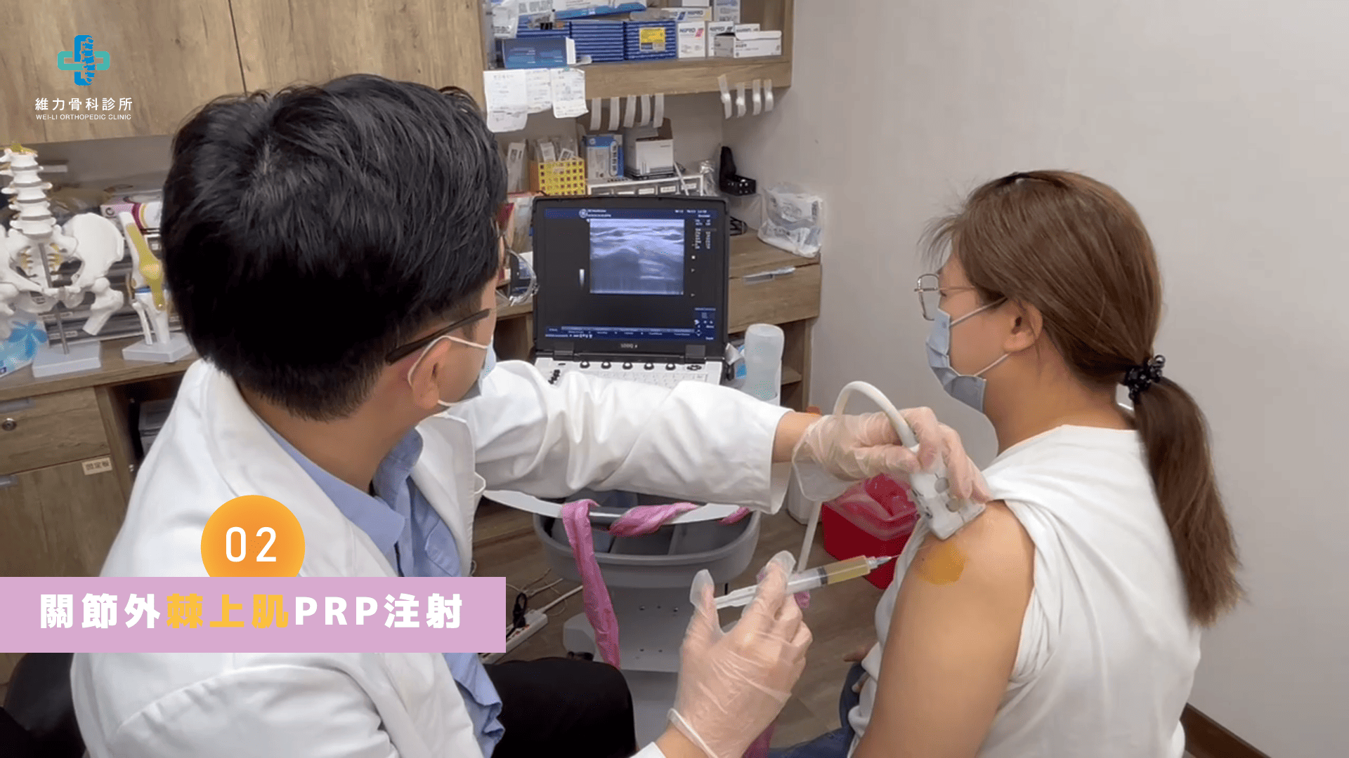 PRP棘上肌注射