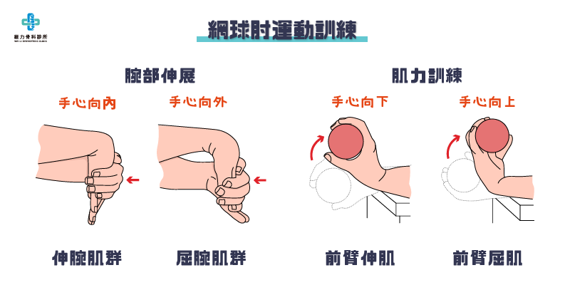 網球肘運動訓練，手腕伸展與肌力訓練