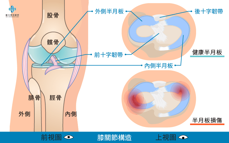 什麼是半月板