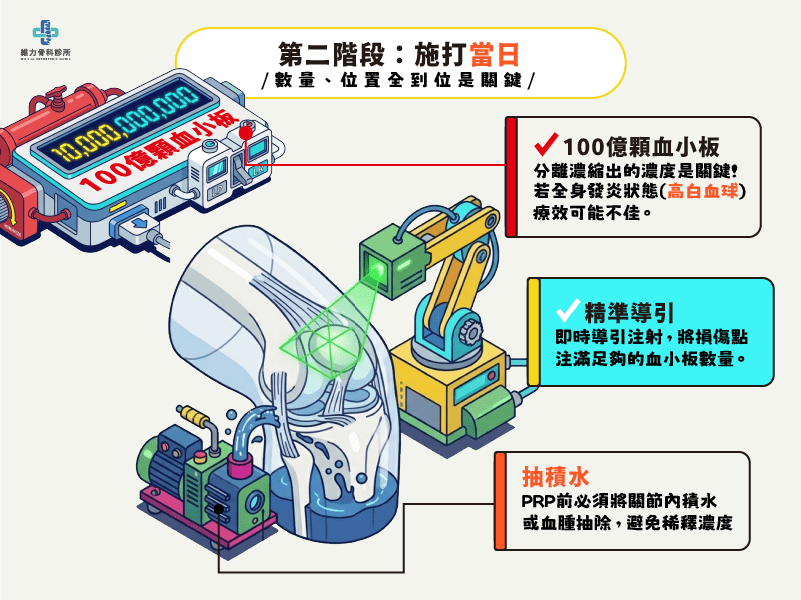 施打前PRP當日決定治療的關鍵點
