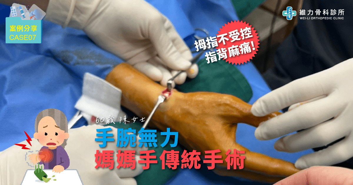 手腕痛媽媽手傳統手術