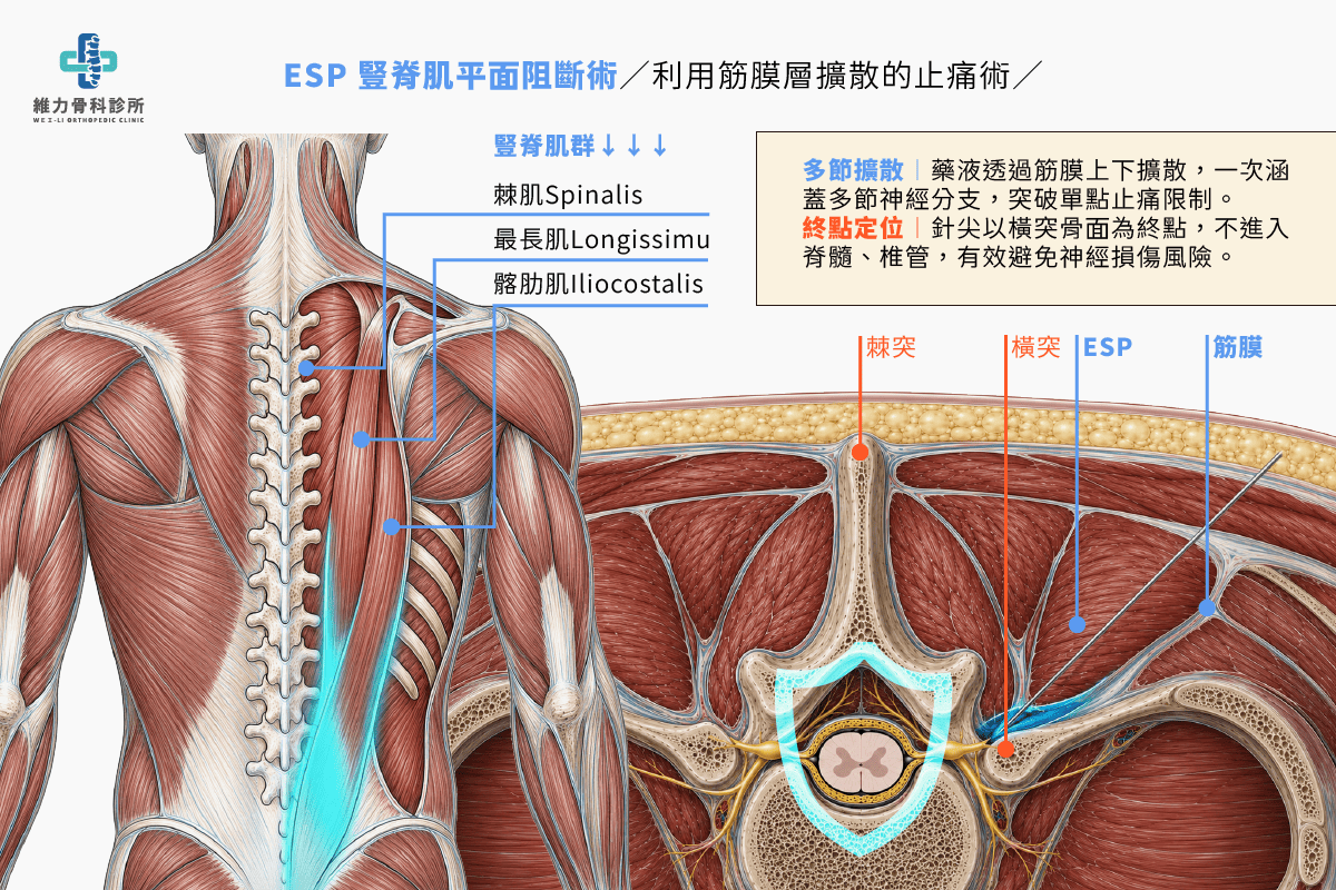 ESP是什麼解剖圖