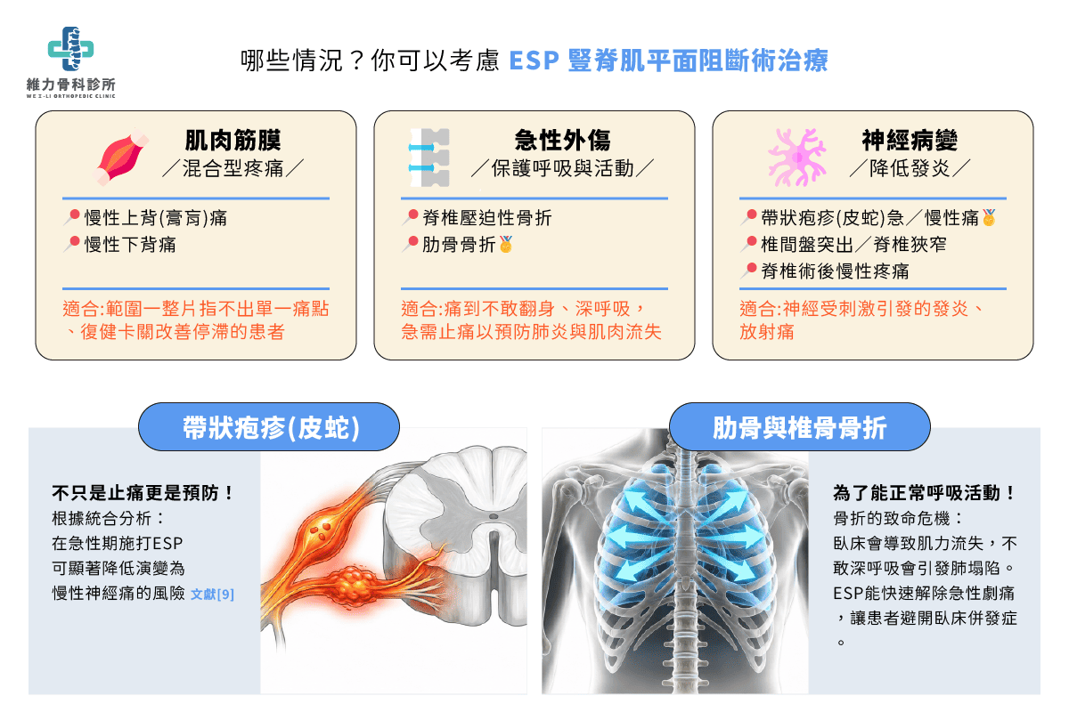 哪些情況適合考慮ESP