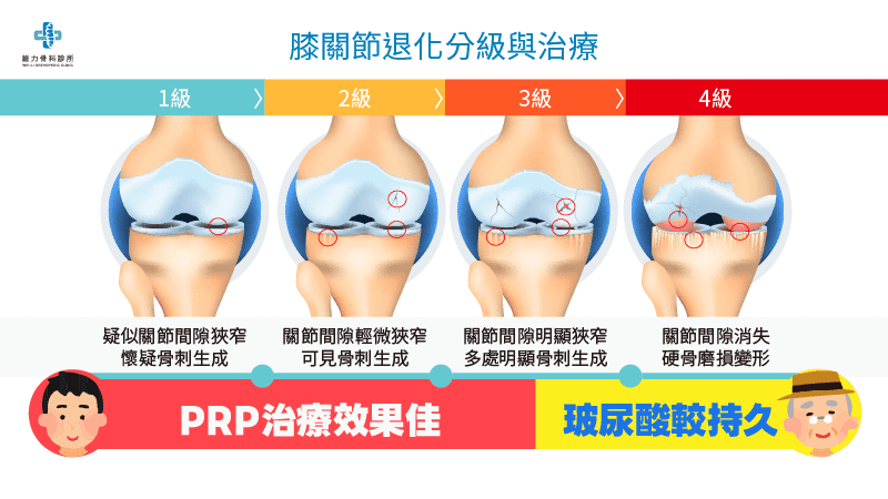 膝蓋退化分級與治療