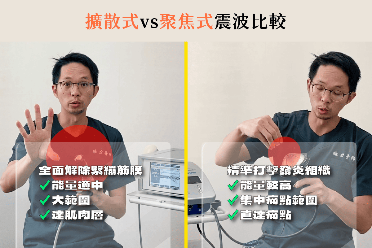 擴散式與聚焦式震波比較