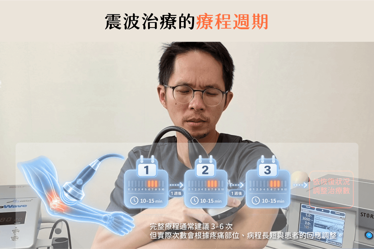 震波治療的療程週期,震波要打幾次才有效