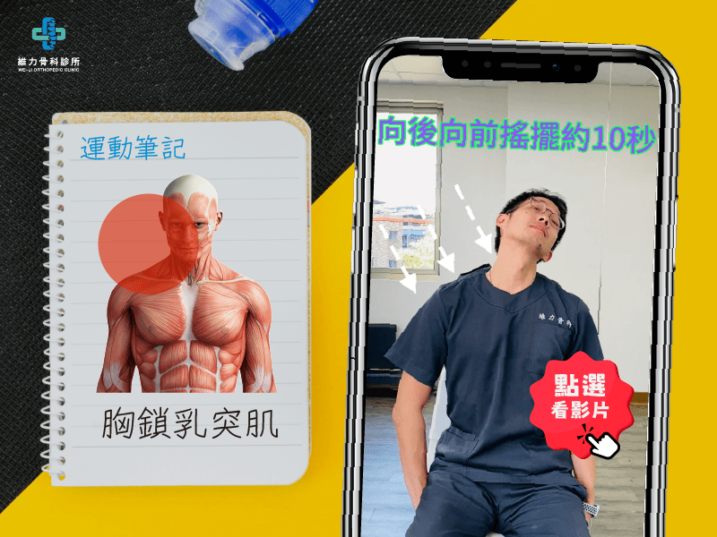 脖子前側痛，胸鎖乳突肌伸展
