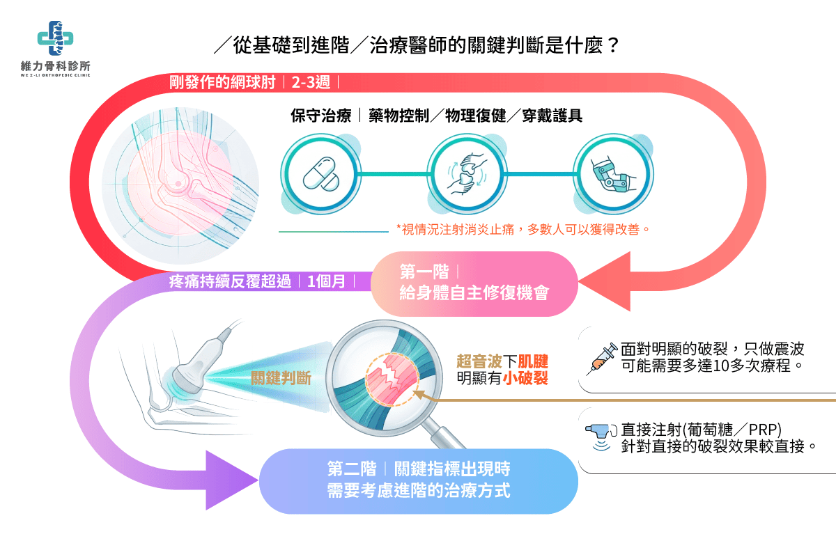 網球肘治療進階流程｜從藥物復健到震波與注射治療評估