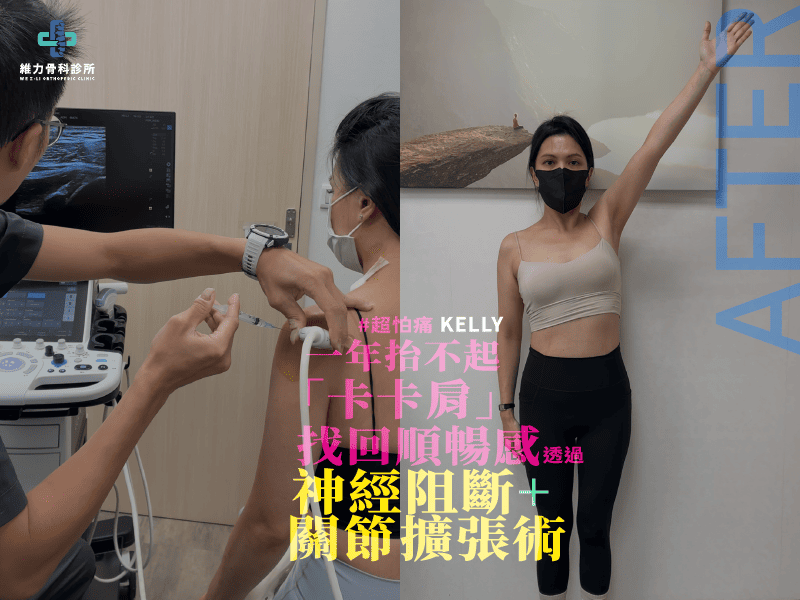 肩關節快速恢復角度的治療案例