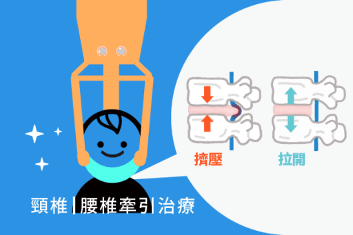 脊椎牽引の結果は何ですか