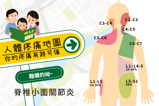 脊椎小面關節炎